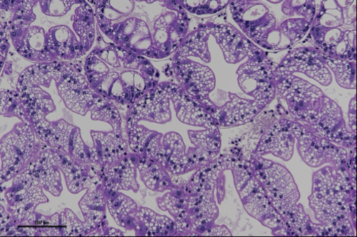 Transverse section of hepatopancreas showing hepatopancreas tubules with different epithelial cell types R-, F-, and B- cells.